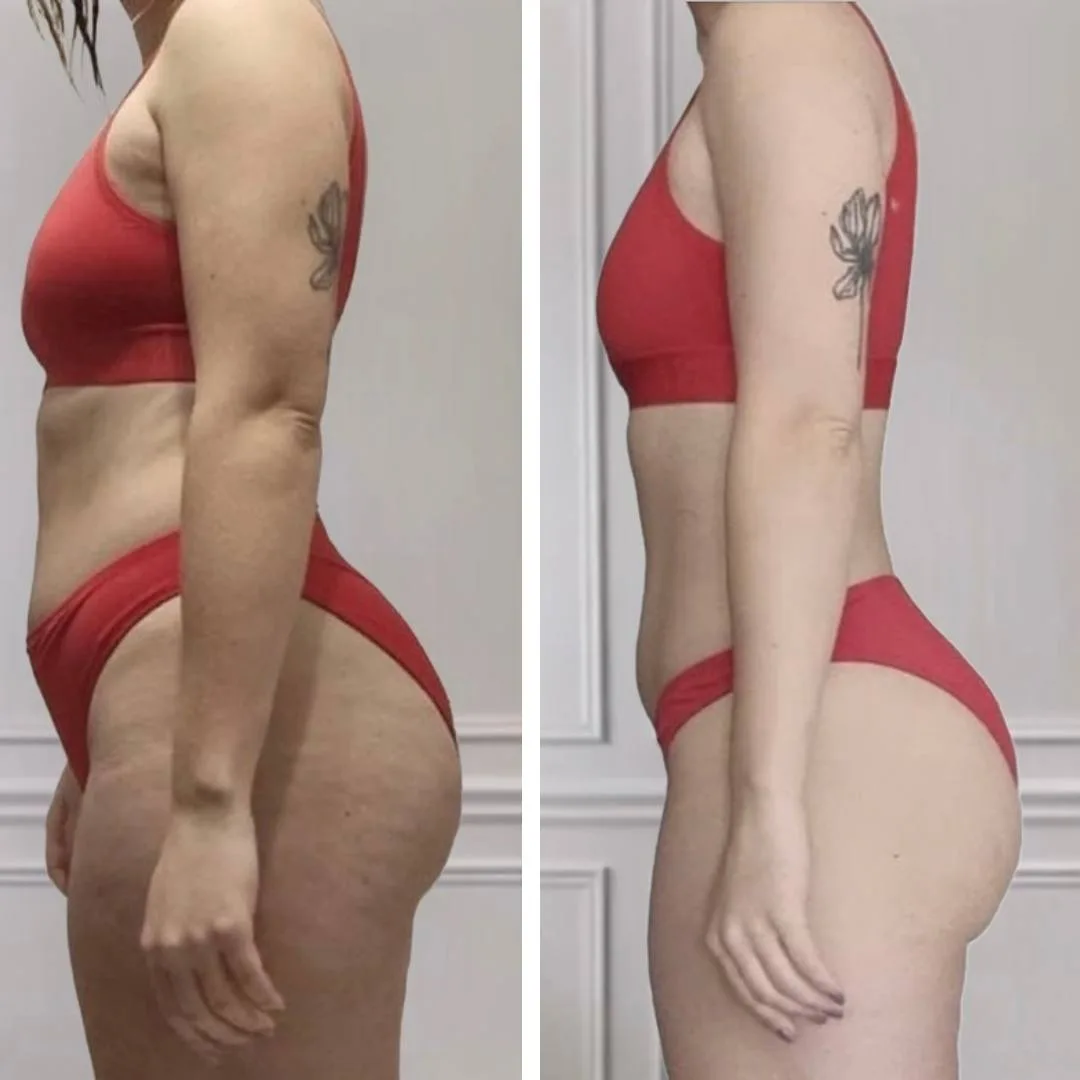 Maren, 38, result